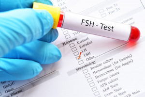 FSH Levels | American Pregnancy Association